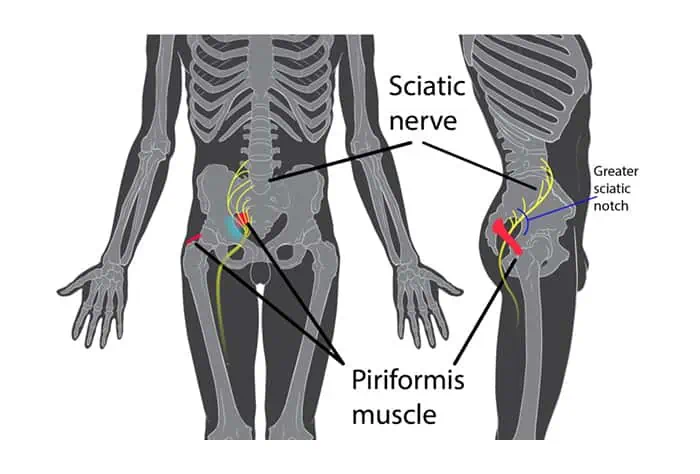 Massage Gun for Sciatica: Does It Help? – Torokhtiy Weightlifting