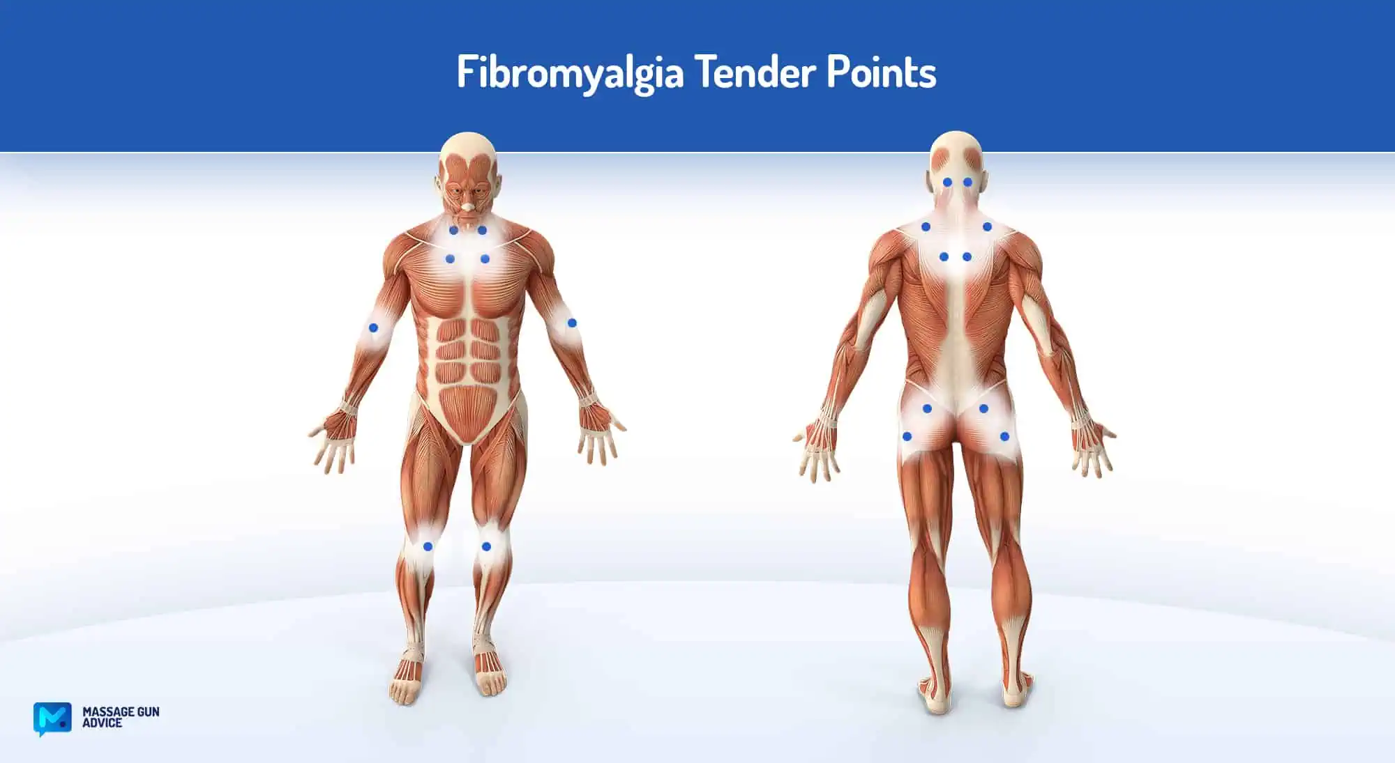 Fibromyalgia Tender Points For Massage Gun